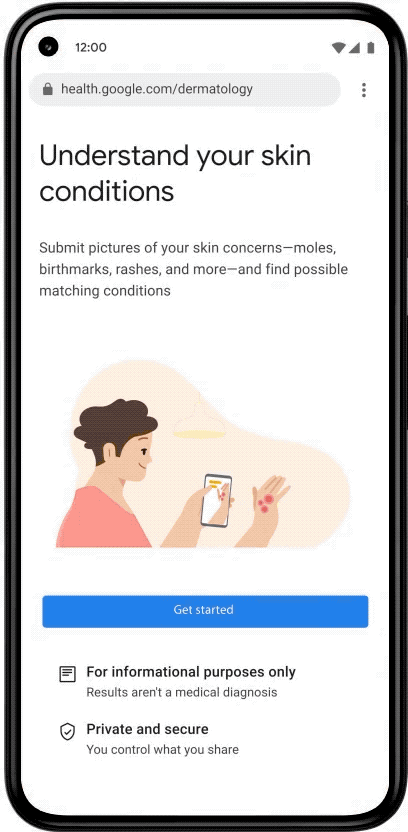 AI-based dermatology tool by Google